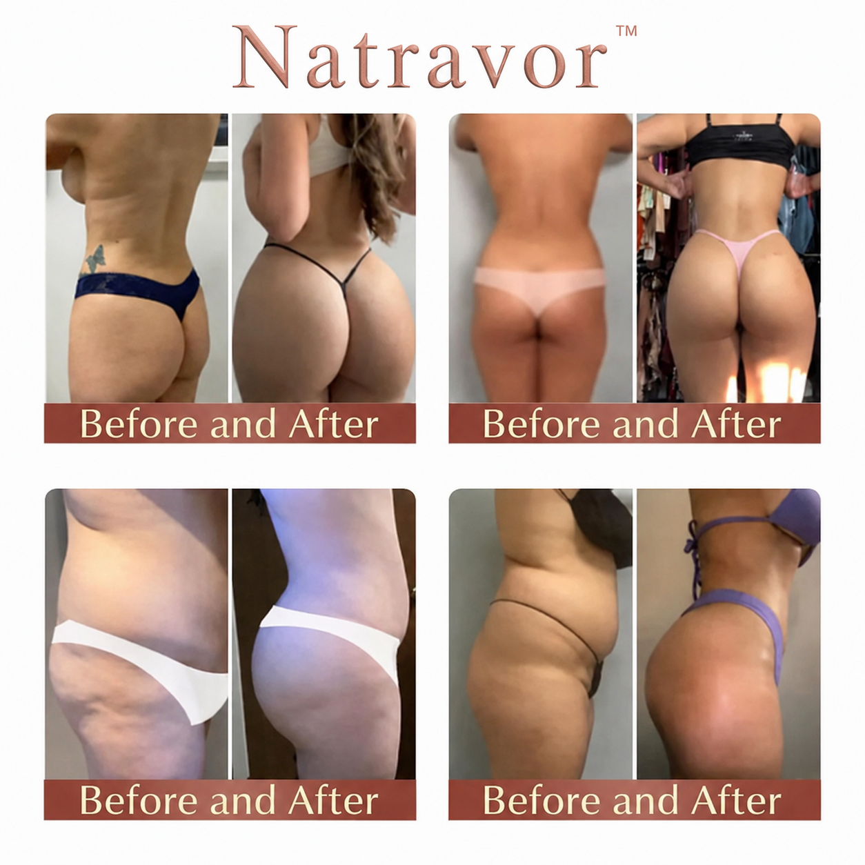 Natravor™ CurveSculpt Micro-Patch ✦ Sculpt • Firm • Smooth Lower Body Curves ✦ Micro-Needle Infusion System