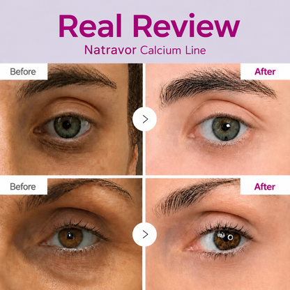 🔥LAST DAY 60% OFF!! Natravor Korean Calcium Dark Spot Eye Cream